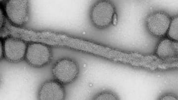 インフルb型 再流行 花粉症の人は特に注意 防災 危機管理トピックス リスク対策 Com 新建新聞社